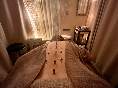 鍼灸ギャラリー1